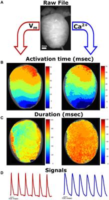 KairoSight: Open-Source Software for the Analysis of Cardiac Optical Data Collected From Multiple Species